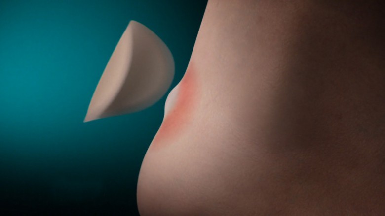 Hoe werkt de hydrocolloïde technologie ?